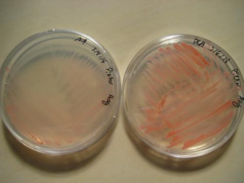 arthrobacter agilis