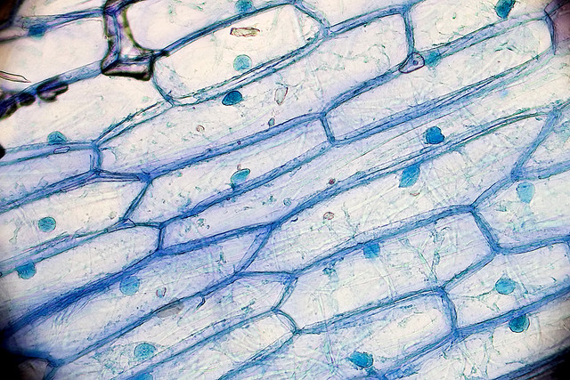 Gram Stain